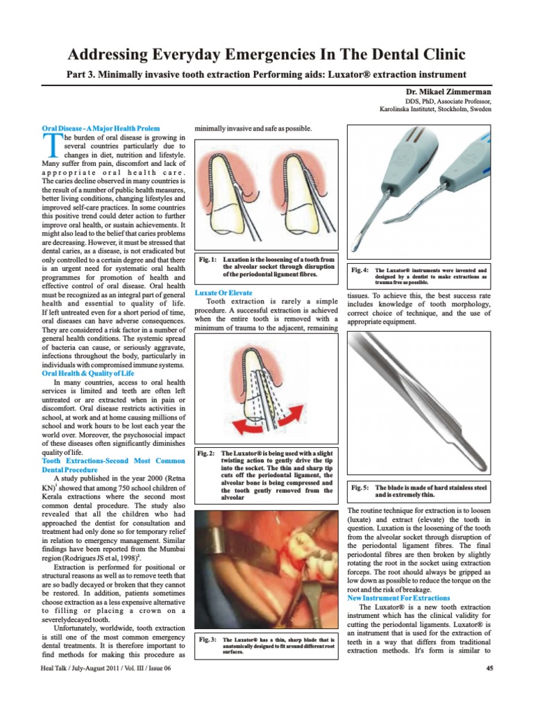 Elevator Dental Implant Dentistry