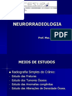 Aula - 10 Neurorradiologia