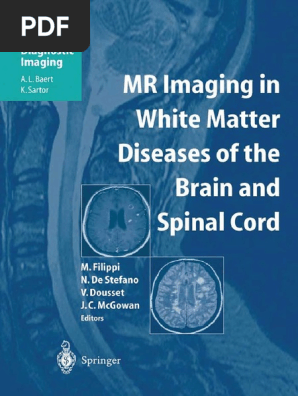 KK MBS-24LTEL-(1) NTT IX 24外線バス標準電話機 [オフィス用品