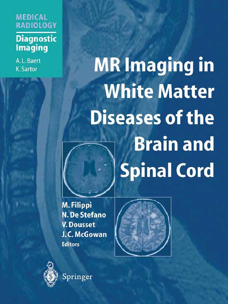 MR Imaging in White Matter Diseases of The Brain and Spinal