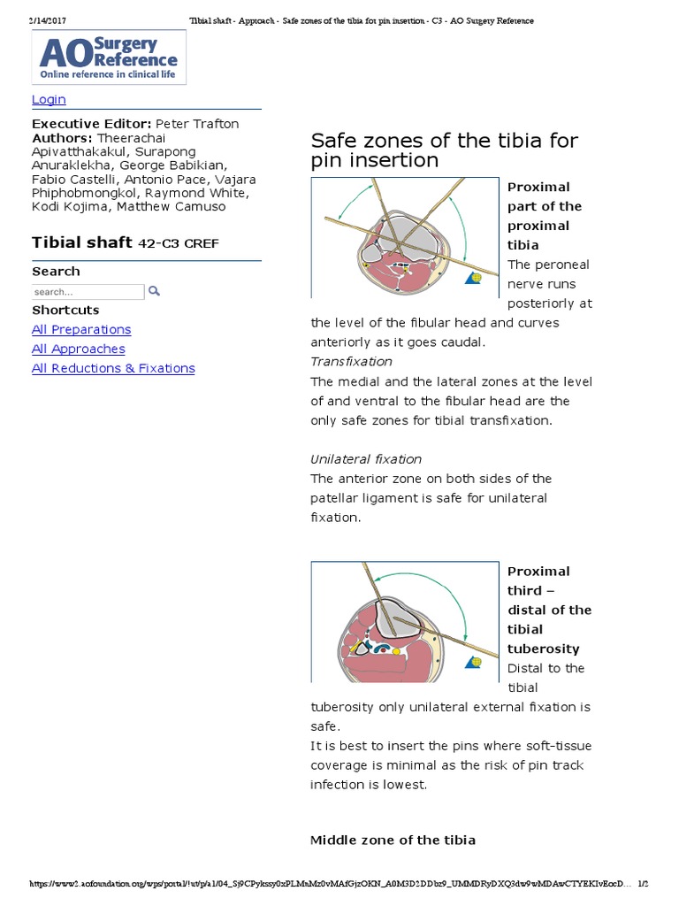 Safe Zones for Tibial Pin Insertion | PDF | Anatomical Terms Of ...