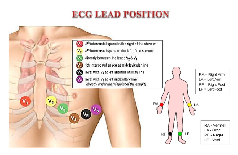 Ecg Lead Position | PDF