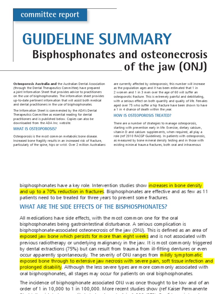 Guideline Summary Bisphosphonates and Osteoradionecrosis of the Jaw