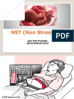 NST (Non Stress Test