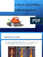 Agenesia Renal Bilateral Eq 1