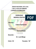 Verrugas, Herpes Zóster