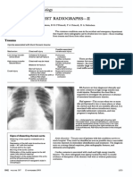 Chest Radiografphs