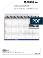 Eeg v12 Folleto