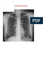 Album de Placas Radiologicas de Torax (Reparado)