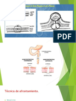 Anastomosis Intestinal - Parte 2/4