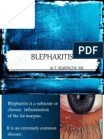 Guide to Understanding Blepharitis