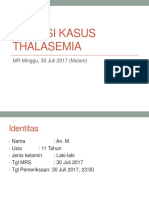 Thalasemia