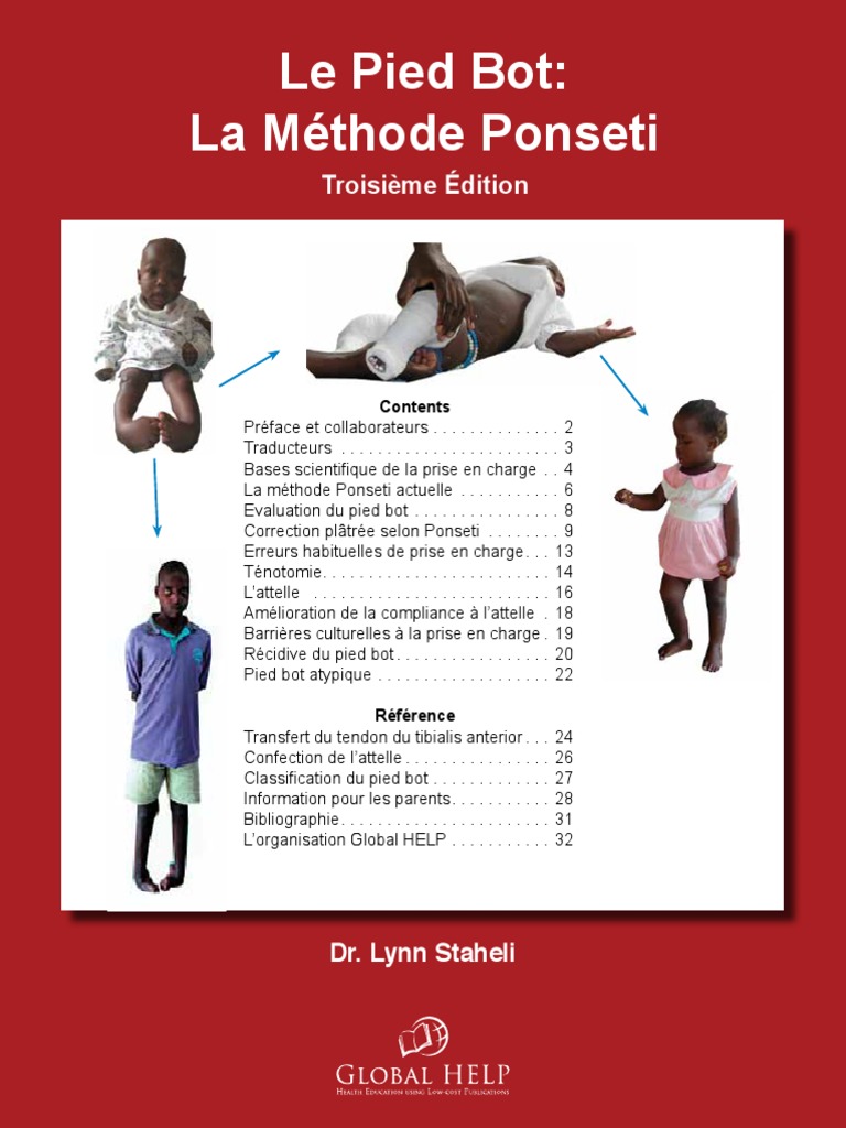 Pied Bot Francais Pied Articulation Anatomie