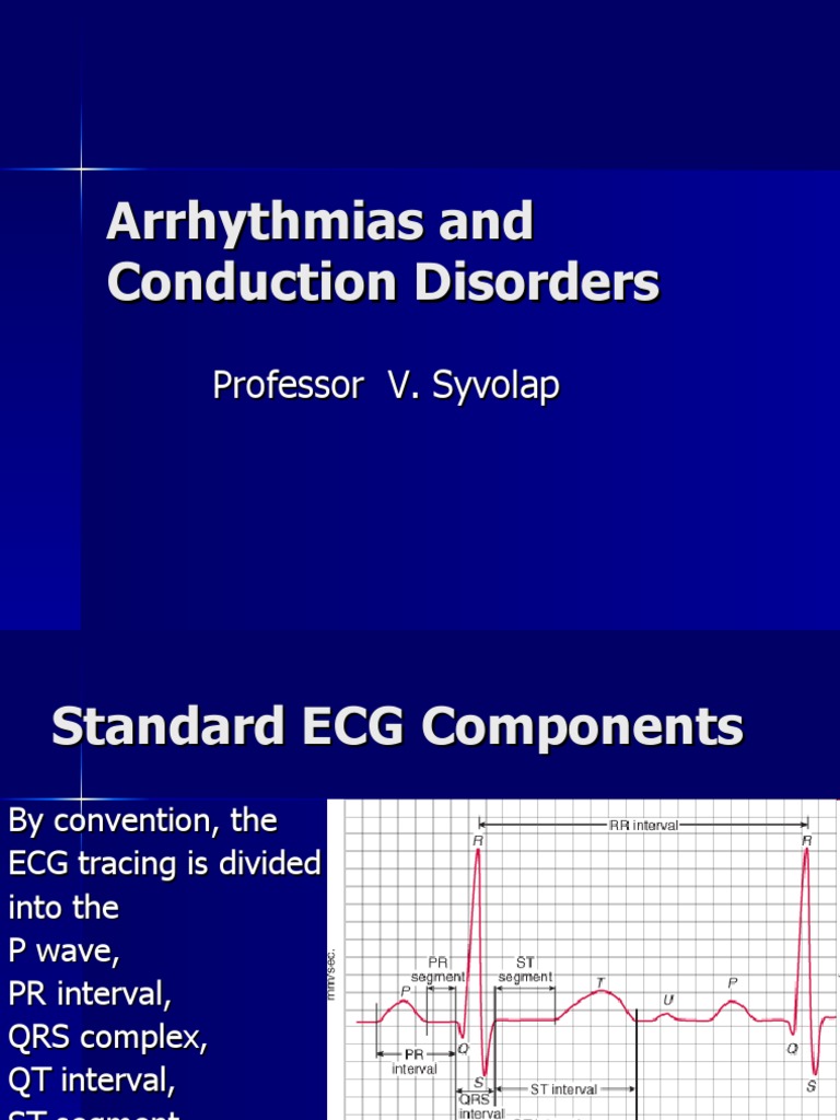 Understanding Arrhythmias and ECG Basics | PDF | Electrocardiography ...