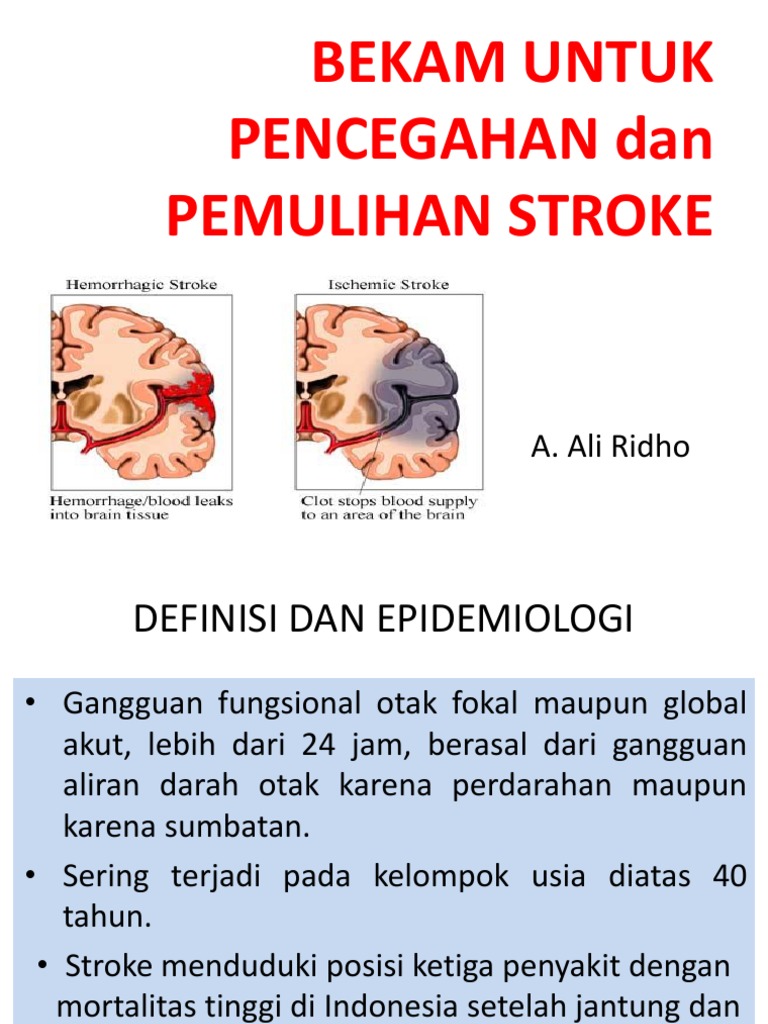 Bekam Untuk Pencegahan Dan Pemulihan Stroke 1