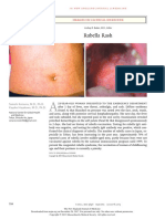 Rubella Rash: Images in Clinical Medicine