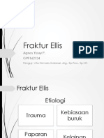 Fraktur Ellis (Gigi)