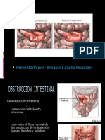 OBSTRUCCION-INTESTINAL.pptx