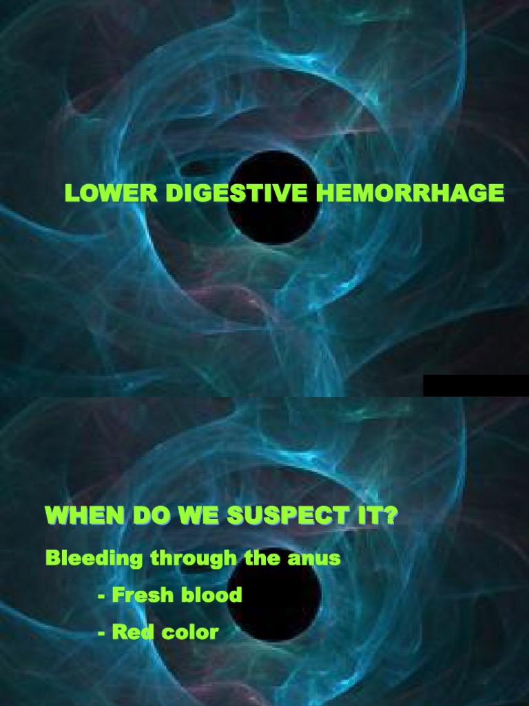 Causes and Diagnosis of Lower Digestive Bleeding | PDF | Colorectal ...