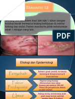 Impetigo Krustosa