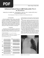 Salbutamol-Induced Narrow QRS Tachycardia: What Is: The Mechanism?