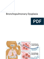 Bronchopulmonary Dysplasia