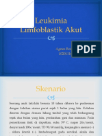 Leukimia Limfoblastik Akut - PPT PBL Blok 24 - 2011 - Agnes