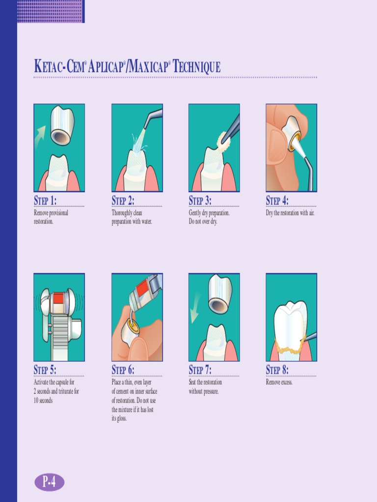 Ketac Cem Aplicap Industrial Processes Industries