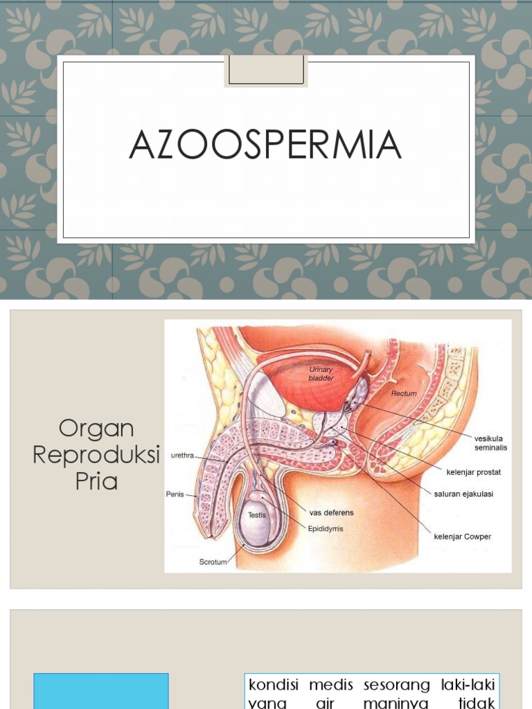 Azoospermia