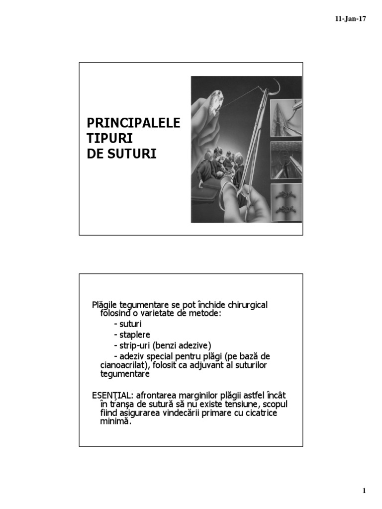 1 Principalele Tipuri de Suturi | PDF