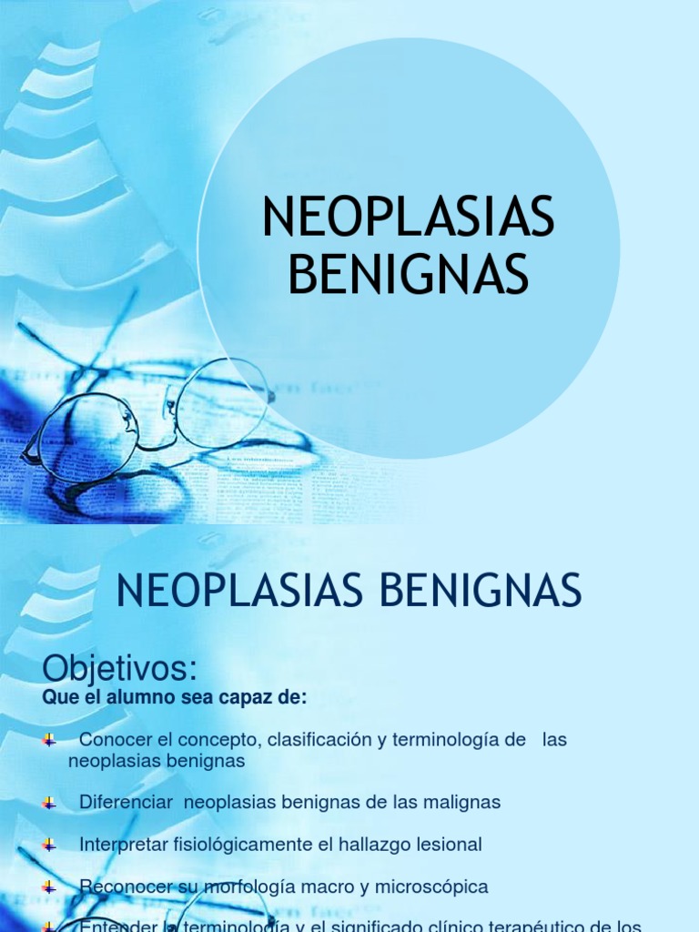 Neoplasias Benignas Ppt Neoplasias Hueso