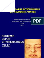 Systemic Lupus Erythematosus & Rheumatoid Arthritis: Hildebrand Hanoch Victor Departemen Ilmu Penyakit Dalam FK Uki 2014