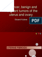 Uterine Fibroids and Endometrial Cancer Diagnosis and Treatment