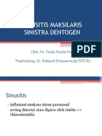 Sinusitis Maksilaris Dentogen Sinistra