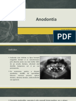 Anodontia, MD 4.pptx