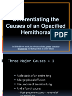 3.causes of Opacified CXR