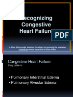 9.congestive Heart Failure