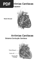 Arritmias Cardíacas SLIDES