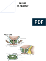 CA Prostate