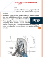 Pengukuran JVP