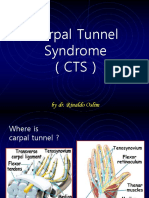 Carpal Tunnel Syndrome (CTS) : by Dr. Rinaldo Oslim