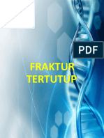 Fraktur Tertutup