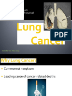 Lung Cancer - Shoyab PDF