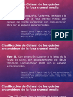 Clasificación de Galassi de Los Quistes Aracnoideos