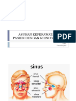 Askep Kmb Sinusitis