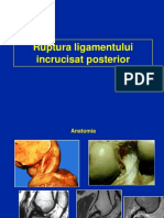 05 - Ligament Incrucisat Posterior