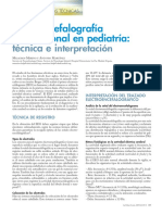 Efalografía Convencional en Pediatría:: Electroenc