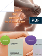 Toxemia Embarazo