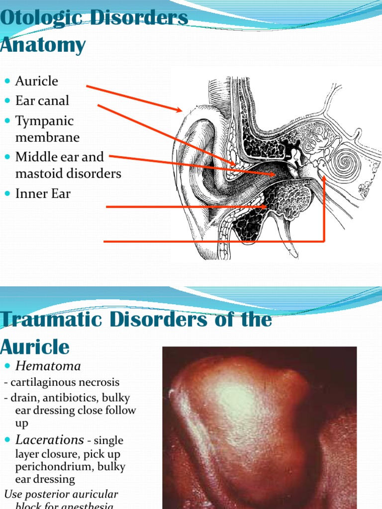 Bellocq Nasal Pack in Epistaxis Management | PDF | Ear | Larynx