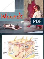 Wounds 7-12-17